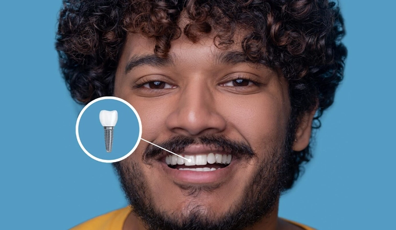 Diş Implantı