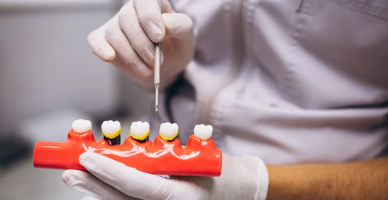 Diş Implantı