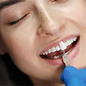 Emax Diş